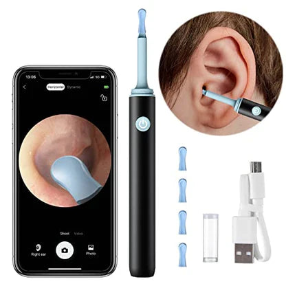 ORBITZ™   - PROFESSIONAL EAR WAX REMOVAL TOOL